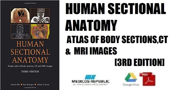 Human Sectional Anatomy Atlas of Body Sections, CT and MRI Images 3rd Edition PDF