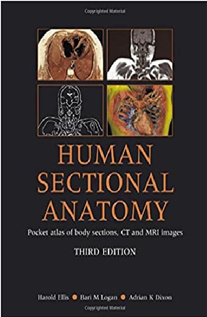 Human Sectional Anatomy: Atlas of Body Sections, CT and MRI Images 3rd Edition PDF