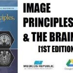 Image Principles, Neck, and the Brain 1st Edition PDF Free Download