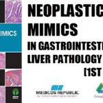 Neoplastic Mimics in Gastrointestinal and Liver Pathology 1st Edition PDF