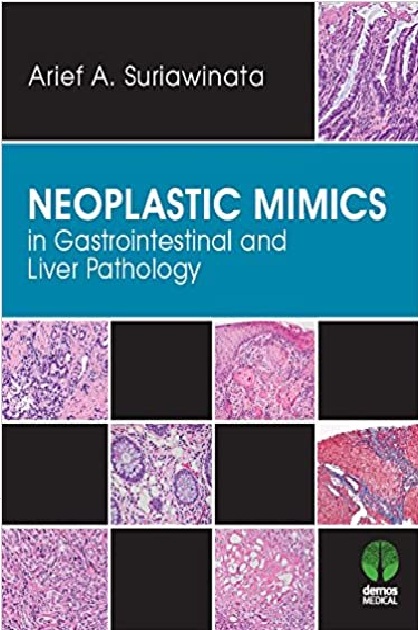 Neoplastic Mimics in Gastrointestinal and Liver Pathology 1st Edition PDF