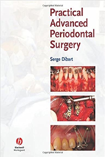 Practical Advanced Periodontal Surgery 1st Edition PDF