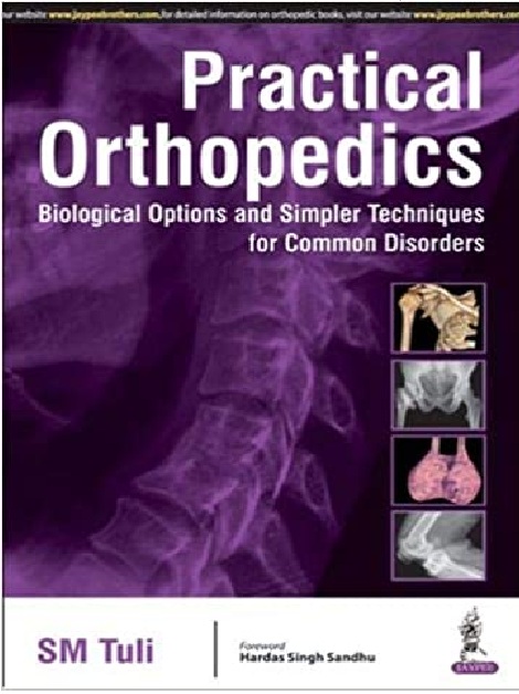 Practical Orthopedics Biological Options and Simpler Techniques for Common Disorders PDF 