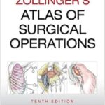 Zollinger’s Atlas of Surgical Operations 10th Edition PDF Free