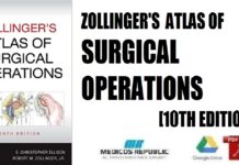 Zollinger’s Atlas of Surgical Operations 10th Edition PDF