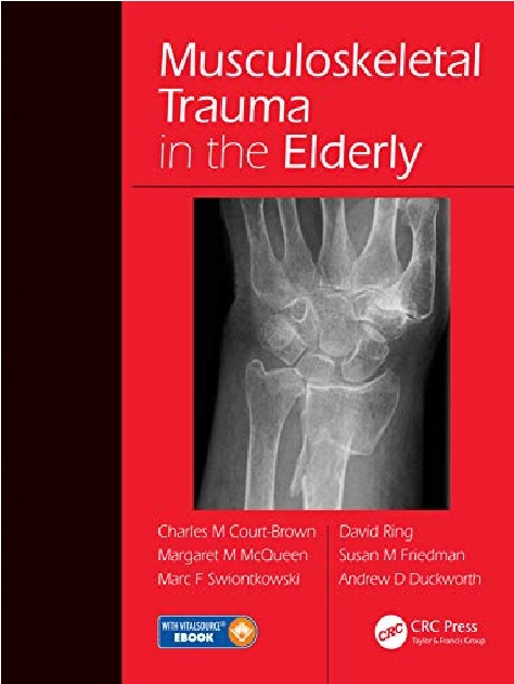 Musculoskeletal Trauma in the Elderly 1st Edition PDF