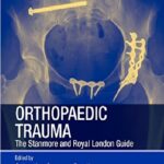Orthopaedic Trauma The Stanmore and Royal London Guide 1st Edition PDF Free Download