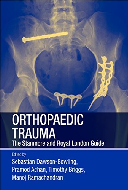 Orthopaedic Trauma: The Stanmore and Royal London Guide 1st Edition PDF