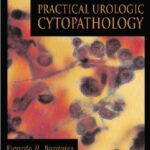 Practical Urologic Cytopathology 1st Edition PDF Free Download