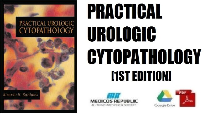 Practical Urologic Cytopathology 1st Edition PDF