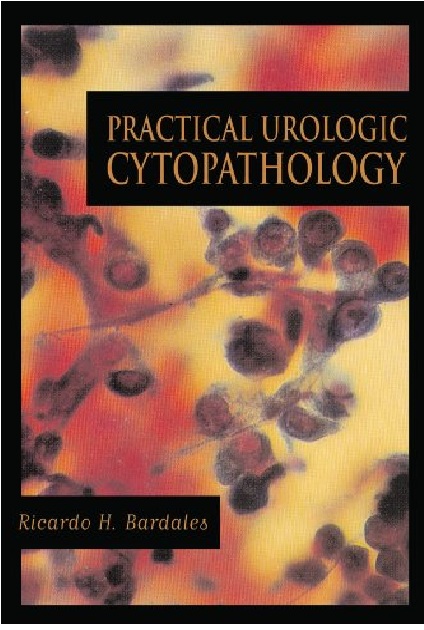 Practical Urologic Cytopathology 1st Edition PDF