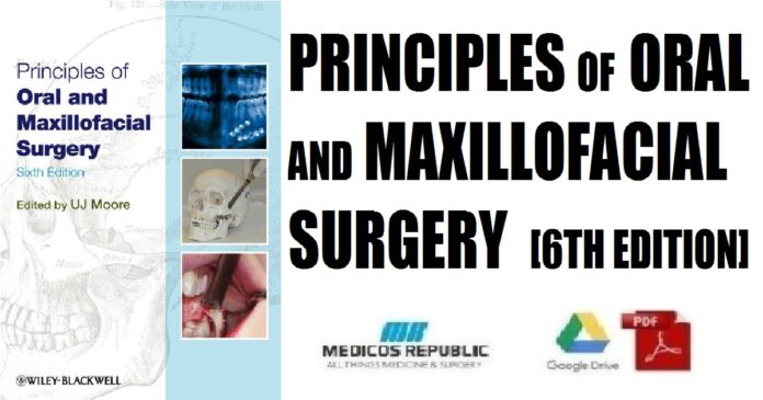 Principles of Oral and Maxillofacial Surgery 6th Edition PDF