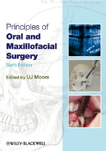 Principles of Oral and Maxillofacial Surgery 6th Edition PDF