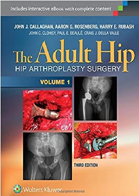 The Adult Hip (Two Volume Set): Hip Arthroplasty Surgery 3rd Edition PDF
