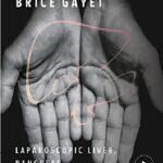 Laparoscopic Liver, Pancreas and Biliary Surgery 1st Edition PDF Free Download