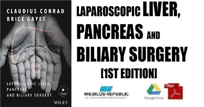 Laparoscopic Liver, Pancreas and Biliary Surgery 1st Edition PDF