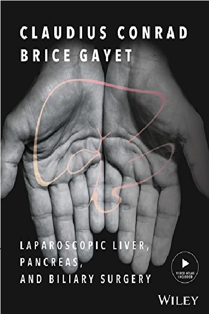 Laparoscopic Liver, Pancreas and Biliary Surgery 1st Edition PDF