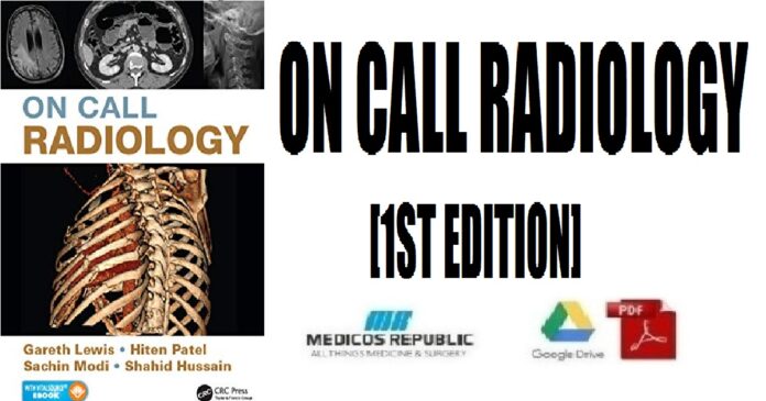 On Call Radiology 1st Edition PDF