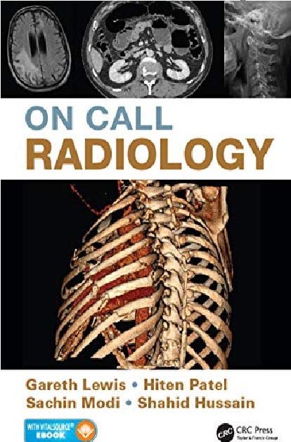 On Call Radiology 1st Edition PDF