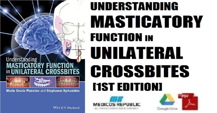 Understanding Masticatory Function in Unilateral Crossbites 1st Edition PDF