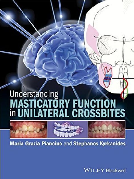 Understanding Masticatory Function in Unilateral Crossbites 1st Edition PDF