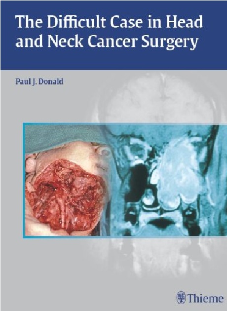 Difficult Case in Head and Neck Cancer Surgery 1st Edition PDF