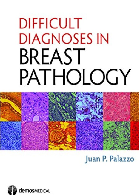 Difficult Diagnoses in Breast Pathology 1st Edition PDF