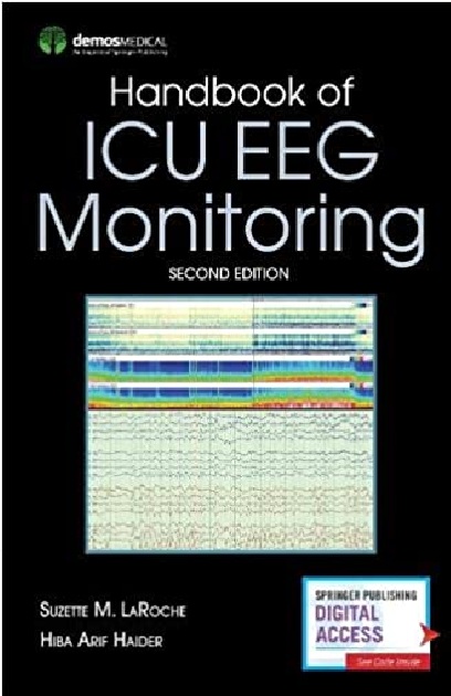 Handbook of ICU EEG Monitoring 2nd Edition PDF