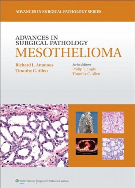 Advances in Surgical Pathology Mesothelioma PDF