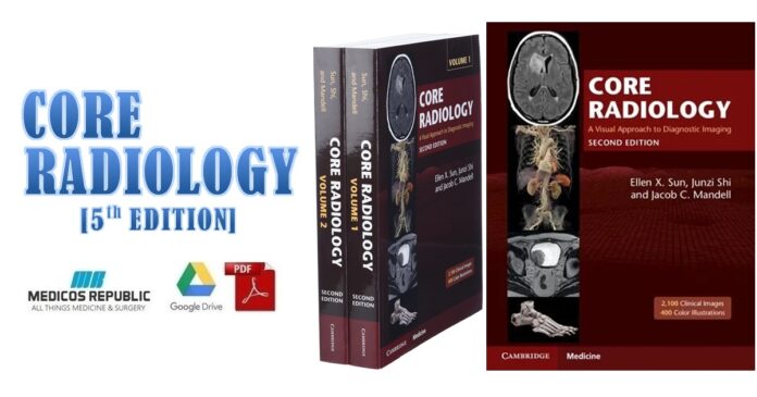 Core Radiology: A Visual Approach to Diagnostic Imaging 2nd Edition PDF