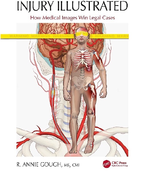 Injury Illustrated How Medical Images Win Legal Cases 1st Edition PDF