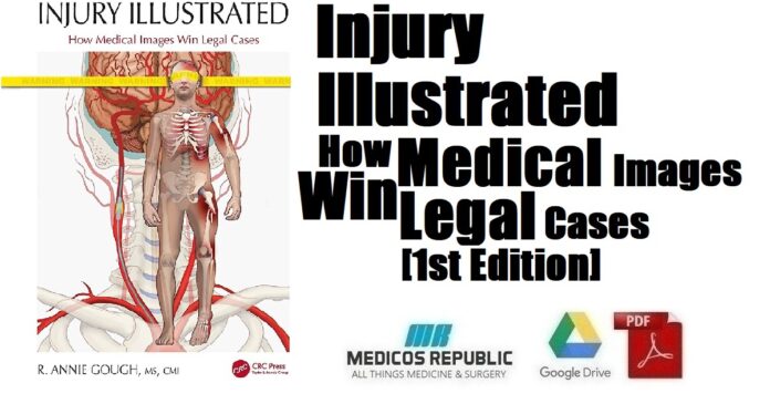 Injury Illustrated How Medical Images Win Legal Cases 1st Edition PDF