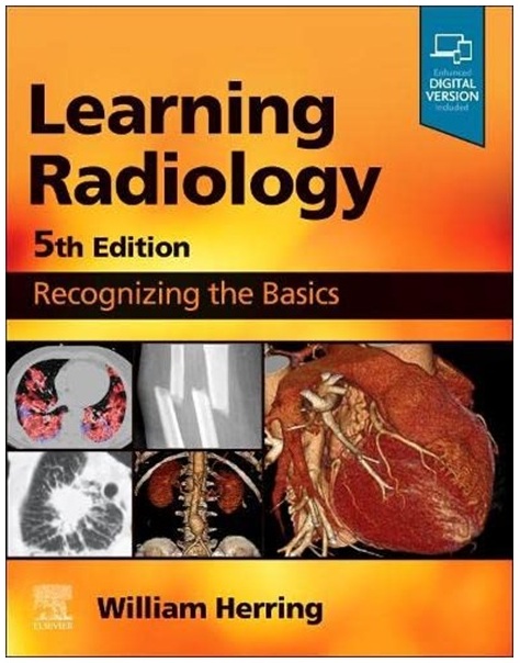 Learning Radiology: Recognizing the Basics 5th Edition PDF