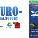 Neuro-Ophthalmology (Color Atlas and Synopsis of Clinical Ophthalmology) PDF
