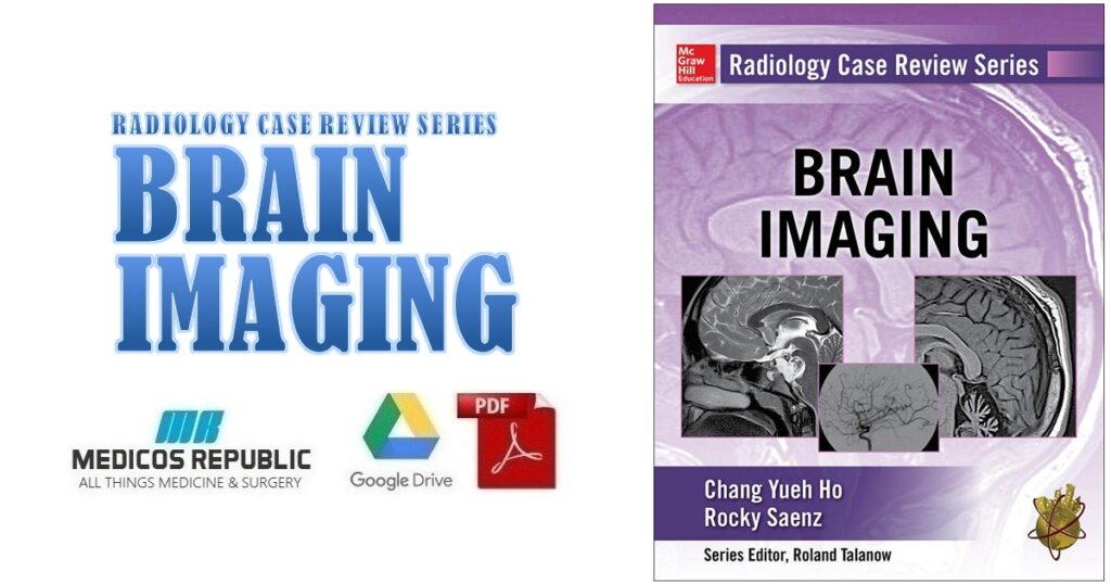 Radiology Case Review Series: Brain Imaging PDF Free Download