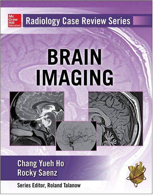 Radiology Case Review Series: Brain Imaging PDF