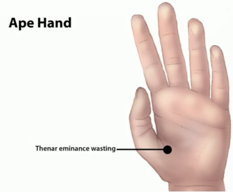 Ape Hand Sign
