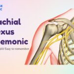 Brachial Plexus Mnemonic