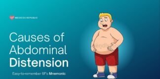 Causes of Abdominal Distension Mnemonic