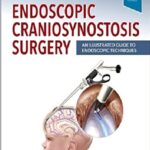 Endoscopic Craniosynostosis Surgery: An Illustrated Guide to Endoscopic Techniques 1st Edition PDF