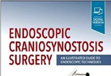 Endoscopic Craniosynostosis Surgery: An Illustrated Guide to Endoscopic Techniques 1st Edition PDF