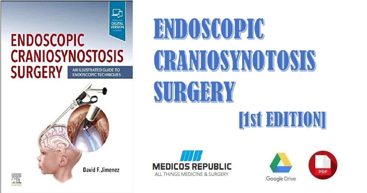 Endoscopic Craniosynostosis Surgery An Illustrated Guide to Endoscopic Techniques 1st Edition PDF