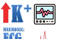 Hyperkalemia ECG Changes Mnemonic