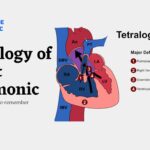 Tetralogy of Fallot Mnemonic