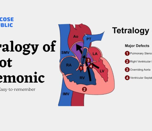 Tetralogy of Fallot Mnemonic