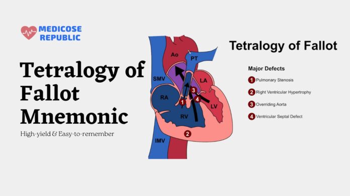 Tetralogy of Fallot Mnemonic