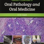 Cawson's Essentials of Oral Pathology and Oral Medicine PDF