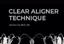 Clear Aligner Technique PDF