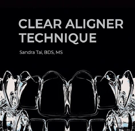 Clear Aligner Technique PDF