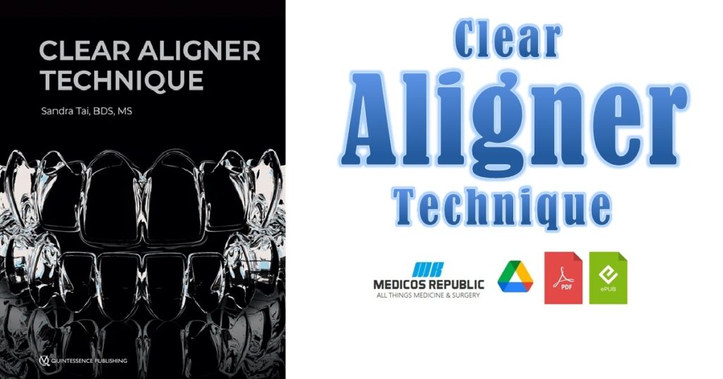 Clear Aligner Technique PDF